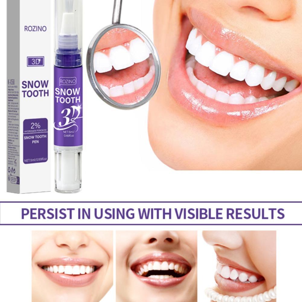 Caneta de Cuidados Dentários O - Teeth Whitening Pens avaliação e preço